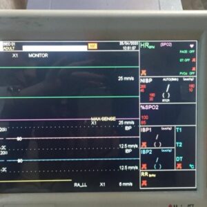 اجاره مانیتور علایم حیاتی رنگی بیمارستانی - شفایارطب