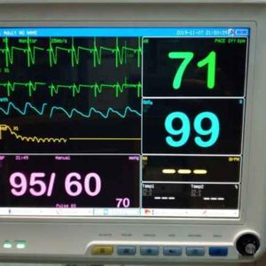 اجاره مانیتور علایم حیاتی رنگی بیمارستانی – شفایارطب