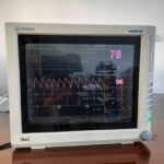 اجاره مانیتور علایم حیاتی رنگی بیمارستانی - شفایارطب