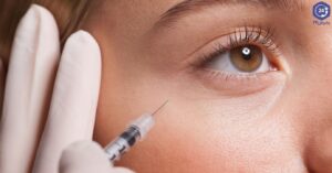 معایب تزریق فیلر